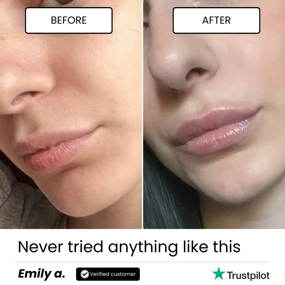 Plumpy Lip Boost | Lip Lifting Effect Treatment