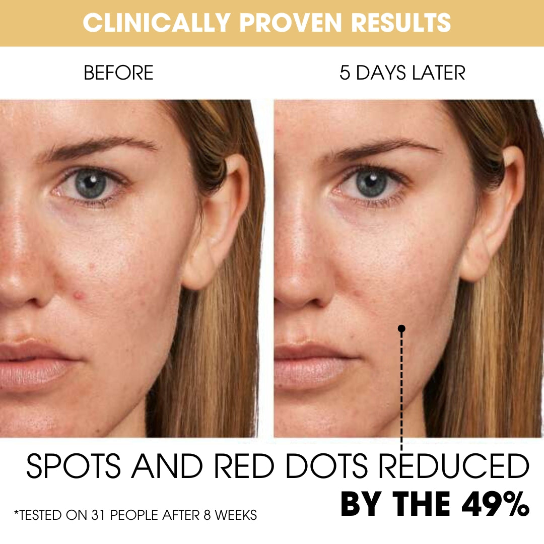 Gel with Vitamin C Capsules