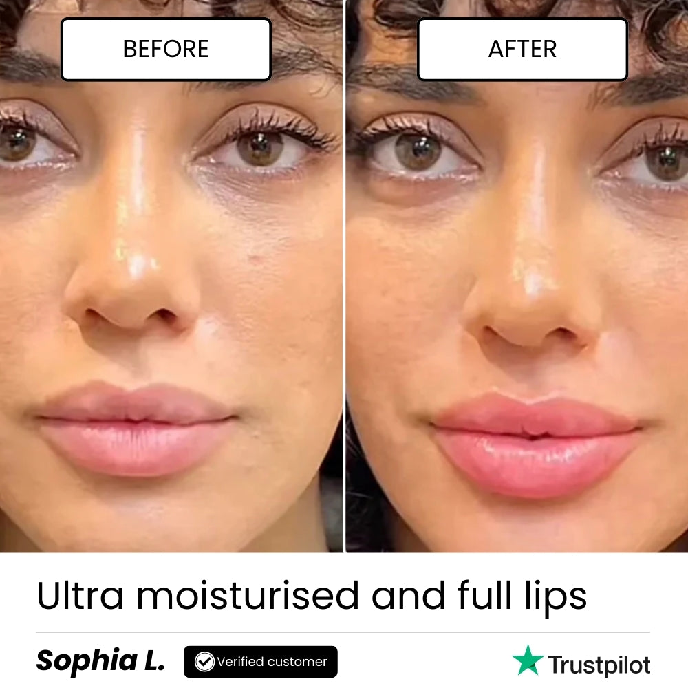 Plumpy Lip Boost | Lip Lifting Effect Treatment