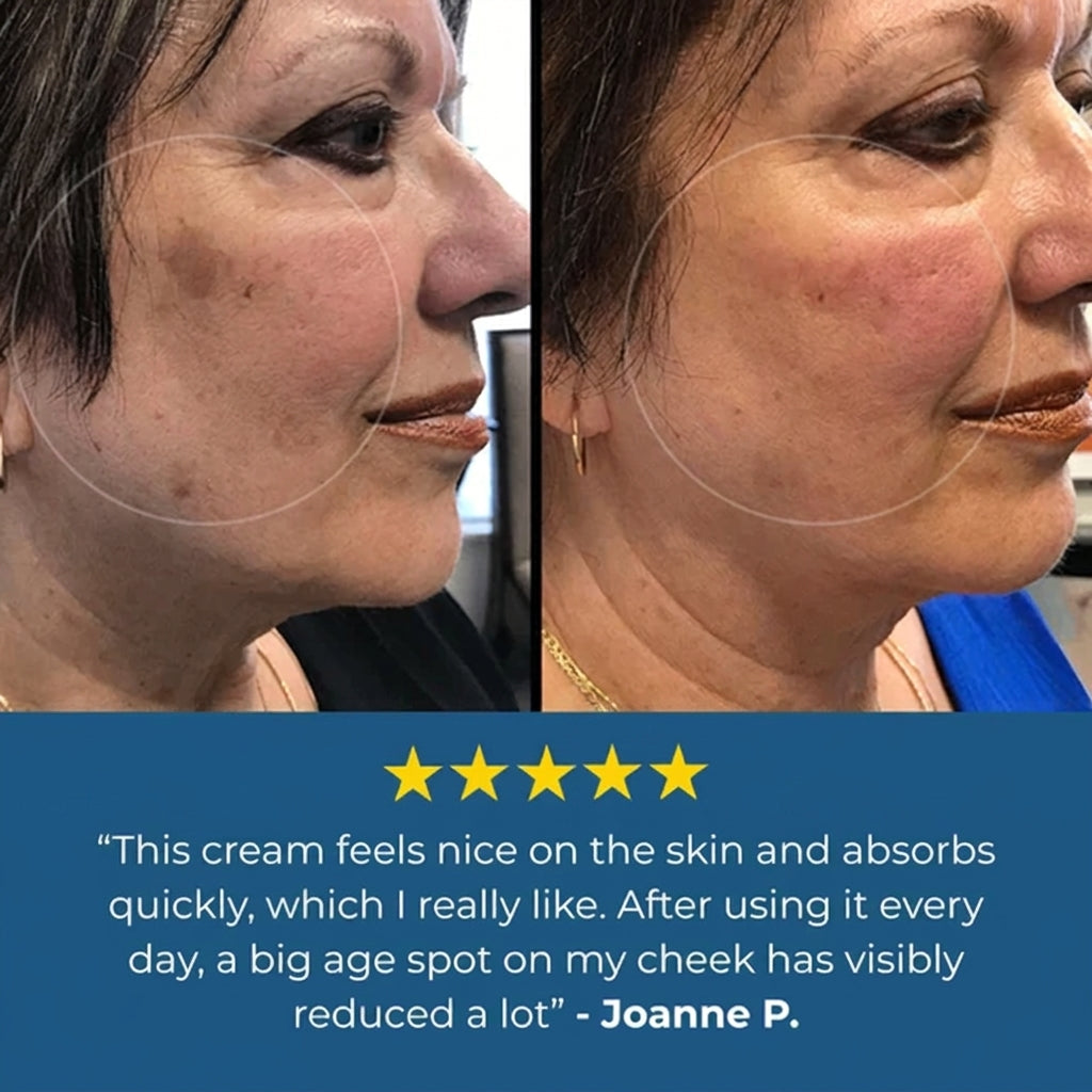 Kyokora™ Age Spot Cream | Reduce dark spots by 93% in just 7 days